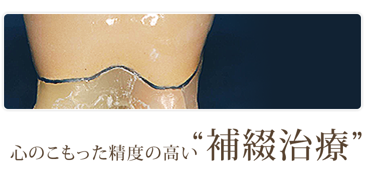 心のこもった精度の高い"補綴治療"